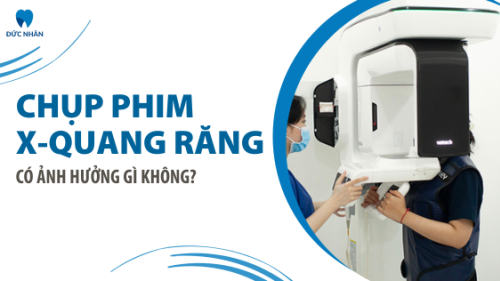 Giải đáp: Chụp X-quang răng có ảnh hưởng gì không và thắc mắc liên quan